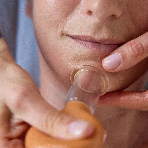 Face Cupping Kit